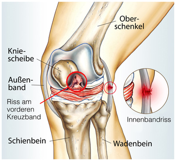 Abbildung des Knieaufbaus